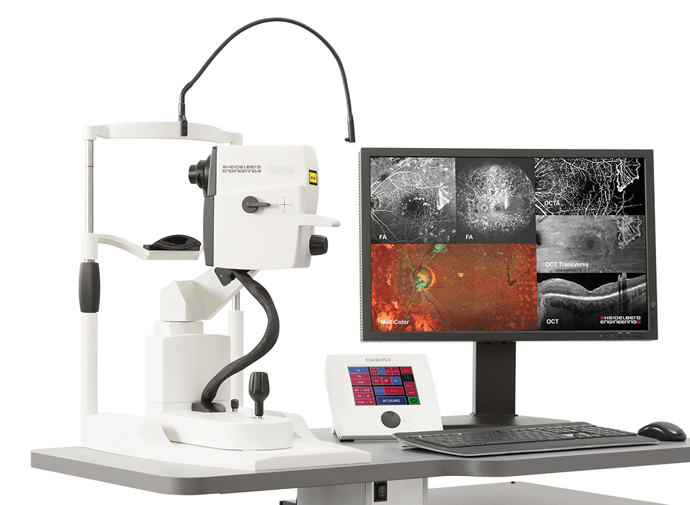OCT - Tomographie en cohérence optique - Image haute résolution de l'œil