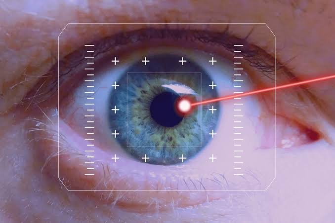 Chirurgie réfractive : un bon investissement ?